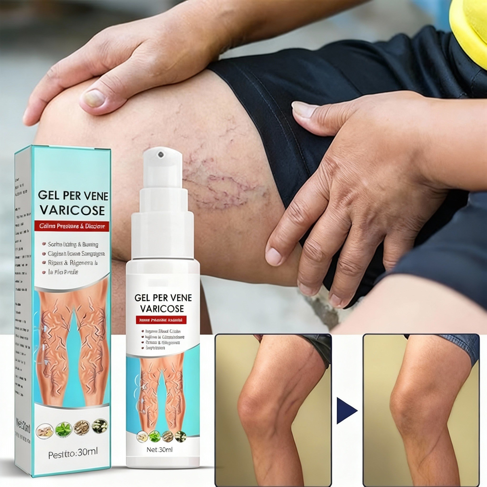 2 x VeinCare Gel Moderato, Crema per Vene Varicose, Trattamento per le Vene Varicose delle Gambe, Gel Lenitivo per Vene Varicose, Migliora la Circolazione Sanguigna e Allevia il Gonfiore.